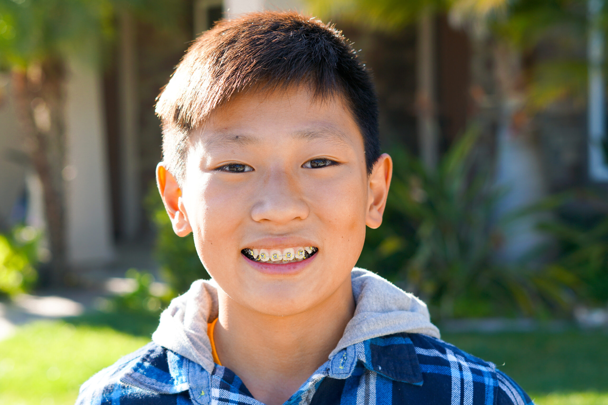 Braces cost in Charlotte NC