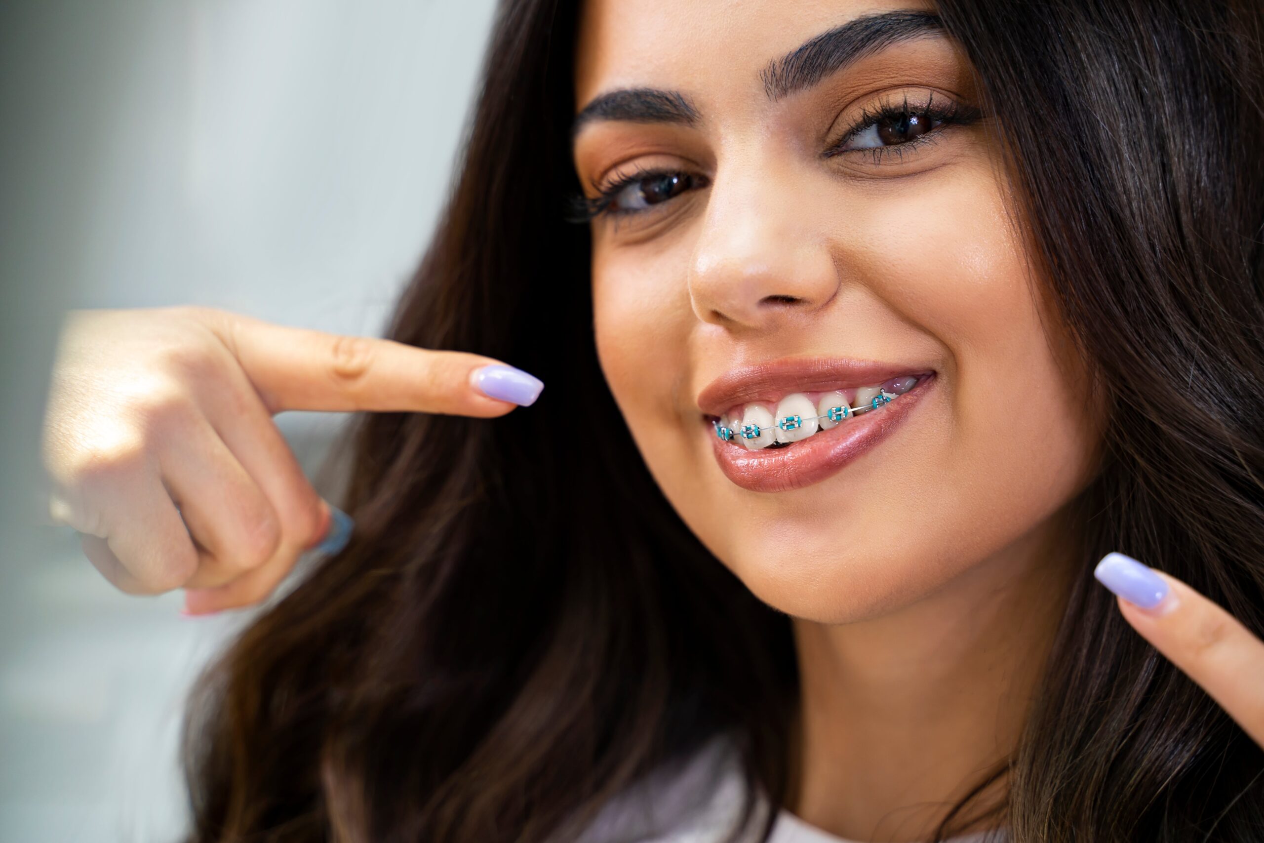Braces cost in Charlotte NC